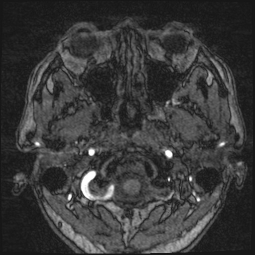 Click on the Serie image to view the images of VILLANUEVA, WILLIAM A.